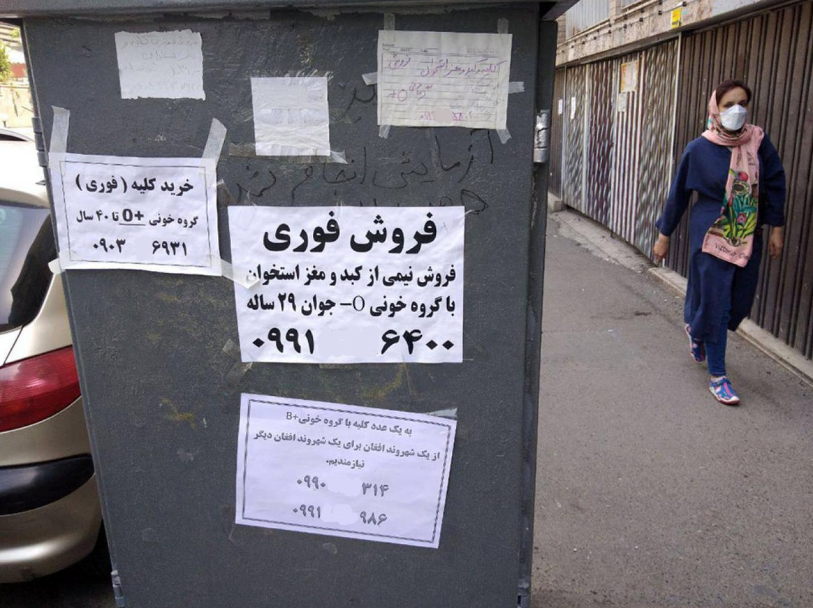 فروش اعضای بچه توسط پدرش/ بی رحم ترین پدر ایرانی که باعث مرگ فرزندش شد